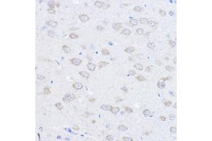 Immunohistochemistry of paraffin-embedded rat brain using UBE4A Rabbit pAb (ABIN6128897, ABIN6149841, ABIN6149842 and ABIN6220229) at dilution of 1:100 (40x lens). (UBE4A 抗体  (AA 797-1066))