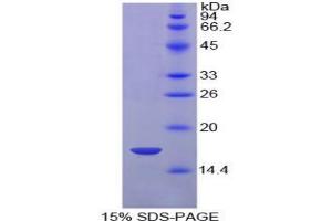 SDS-PAGE (SDS) image for Hypoxia Inducible Factor 1, alpha Subunit (Basic Helix-Loop-Helix Transcription Factor) (HIF1A) protein (ABIN3009908)
