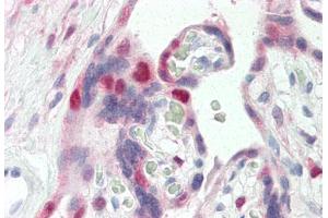Human Placenta (formalin-fixed, paraffin-embedded) stained with CDK2 antibody ABIN337208 at 5 ug/ml followed by biotinylated anti-mouse IgG secondary antibody ABIN481714, alkaline phosphatase-streptavidin and chromogen.