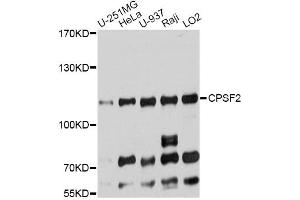 Western blot analysis of extracts of various cell lines, using CPSF2 antibody. (CPSF2 抗体)