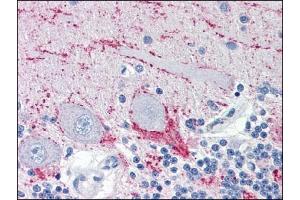 Immunohistochemistry (IHC) image for anti-Vesicle-Associated Membrane Protein 2 (Synaptobrevin 2) (VAMP2) (AA 1-89), (N-Term) antibody (ABIN317061) (VAMP2 抗体  (N-Term))