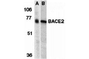 Western Blotting (WB) image for anti-beta-Site APP-Cleaving Enzyme 2 (BACE2) (N-Term) antibody (ABIN1031256) (BACE2 抗体  (N-Term))