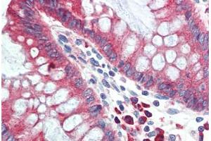 Human Colon (formalin-fixed, paraffin-embedded) stained with HYOU1 antibody ABIN396969 at 5 ug/ml followed by biotinylated goat anti-rabbit IgG secondary antibody ABIN481713, alkaline phosphatase-streptavidin and chromogen. (HYOU1 抗体  (C-Term))