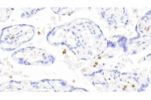 Immunohistochemistry (IHC) image for anti-S100 Calcium Binding Protein A12 (S100A12) (AA 1-92) antibody (ABIN7433135)