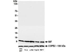 Western Blotting (WB) image for anti-Macrophage Migration Inhibitory Factor (Glycosylation-Inhibiting Factor) (MIF) (AA 2-115) antibody (ABIN7449455)