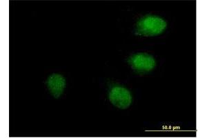 Immunofluorescence of purified MaxPab antibody to ANAPC10 on HeLa cell. (ANAPC10 抗体  (AA 1-185))