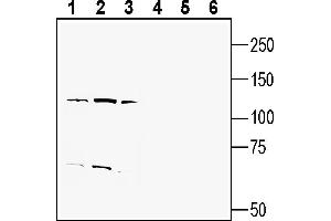 Western blot analysis of human  monocytic leukemia cell line lysate (lanes 1 and 4), human  promyelocytic leukemia cell line lysate (lanes 2 and 5) and human MDA- breast adenocarcinoma cell line lysate (lanes 3 and 6):1-3. (ENPP1 抗体  (Extracellular))