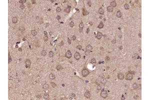 Paraformaldehyde-fixed, paraffin embedded rat brain tissue, Antigen retrieval by boiling in sodium citrate buffer (pH6. (Glutamate Receptor 1 抗体  (pSer863))