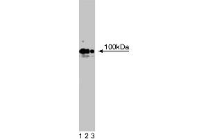 Western blot analysis of R-Cadherin on rat brain lysate. (Cadherin 4 抗体  (AA 22-201))