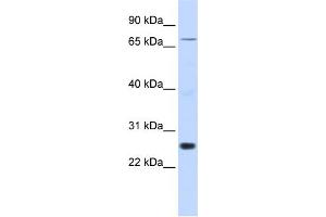 WB Suggested Anti-ZNF267 Antibody Titration:  0. (ZNF267 抗体  (Middle Region))