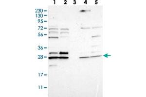 Western blot analysis of Lane 1: RT-4, Lane 2: U-251 MG, Lane 3: Human Plasma, Lane 4: Liver, Lane 5: Tonsil with CNPY4 polyclonal antibody . (CNPY4 抗体)
