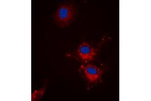 Immunofluorescent analysis of BCLX (pS62) staining in HEK293T cells.