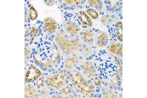 Immunohistochemistry of paraffin-embedded mouse kidney using STX7 antibody (ABIN6128800, ABIN6148669, ABIN6148670 and ABIN6224079) at dilution of 1:100 (40x lens). (Syntaxin 7 抗体  (AA 1-170))