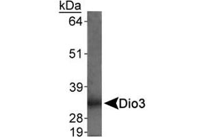 Detection of Dio3 in rat placenta using Dio3 polyclonal antibody . (DIO3 抗体  (AA 250-300))