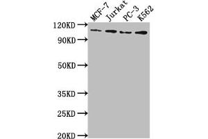 Western Blot Positive WB detected in: MCF-7 whole cell lysate, Jurkat whole cell lysate, PC-3 whole cell lysate, K562 whole cell lysate All lanes: KDM1A antibody at 1:2000 Secondary Goat polyclonal to rabbit IgG at 1/50000 dilution Predicted band size: 93, 96 kDa Observed band size: 110 kDa (Recombinant LSD1 抗体)