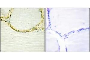 Immunohistochemistry analysis of paraffin-embedded human thyroid gland, using ETK (Phospho-Tyr566) Antibody. (BMX 抗体  (pTyr566))