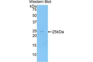 Western blot analysis of the recombinant protein. (NPEPPS 抗体  (AA 584-755))