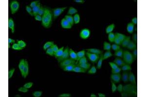 Immunofluorescence staining of PC-3 cells with ABIN7167258 at 1:133, counter-stained with DAPI. (RAB24 抗体  (AA 122-197))