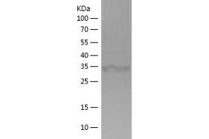 IDH1 Protein (AA 341-414) (His-IF2DI Tag)
