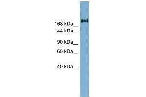 WB Suggested Anti-TMEM2 Antibody Titration:  0. (TMEM2 抗体  (Middle Region))