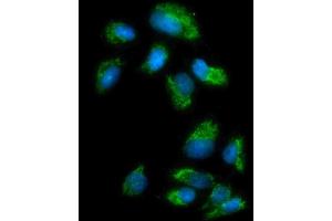 anti-Monoamine Oxidase A (MAOA) (AA 457-493), (C-Term) antibody