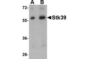 Western Blotting (WB) image for anti-serine threonine Kinase 39 (STK39) (Middle Region) antibody (ABIN1031111) (STK39 抗体  (Middle Region))