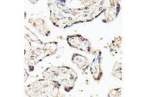 Immunohistochemistry of paraffin-embedded human placenta using KLF5 antibody (ABIN3023447, ABIN3023448, ABIN3023449 and ABIN6219969) at dilution of 1:100 (40x lens). (KLF5 抗体  (AA 1-250))