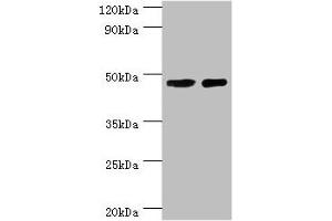 Western blot All lanes: SMAD3 antibody at 8 μg/mL Lane 1: Jurkat whole cell lysate Lane 2: A431 whole cell lysate Secondary Goat polyclonal to rabbit IgG at 1/10000 dilution Predicted band size: 49, 44, 36, 26 kDa Observed band size: 49 kDa (SMAD3 抗体  (AA 1-230))