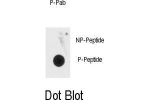 Image no. 1 for anti-Methyl CpG Binding Protein 2 (MECP2) (pSer80) antibody (ABIN358521) (MECP2 抗体  (pSer80))