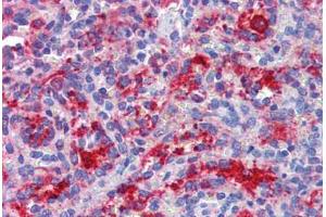 Spleen, Human: Formalin-Fixed, Paraffin-Embedded (FFPE) (DDX58 抗体)