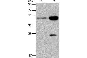 Western blot analysis of 231 and Hela cell, using CD160 Polyclonal Antibody at dilution of 1:300 (CD160 抗体)