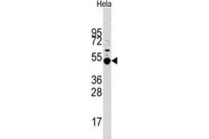Western Blotting (WB) image for anti-Mitogen-Activated Protein Kinase-Activated Protein Kinase 5 (MAPKAPK5) antibody (ABIN3003051) (MAPKAP Kinase 5 抗体)