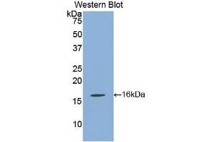 WB of Protein Standard: different control antibodies against Highly purified E. (Klotho beta ELISA 试剂盒)