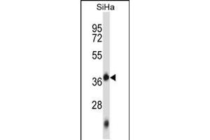 Western blot analysis in SiHa cell line lysates (35ug/lane). (DNTTIP1 抗体  (AA 145-174))