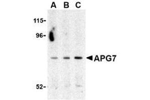 Western blot analysis of ATG7 in Caco-2 cell lysate with ATG7 Antibody at (A) 0. (ATG7 抗体  (C-Term))