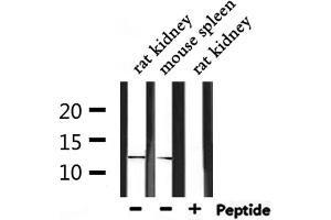 Western blot analysis of extracts from rat kidney and mouse spleen, using IGFL2 Antibody. (IGFL2 抗体)