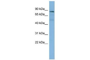 PTPN12 antibody used at 1 ug/ml to detect target protein. (PTPN12 抗体  (Middle Region))
