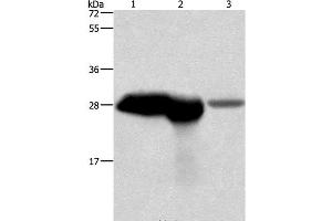 Western Blot analysis of Mouse brain and kidney tissue, Human fetal brain tissue using CALB1 Polyclonal Antibody at dilution of 1:750 (CALB1 抗体)