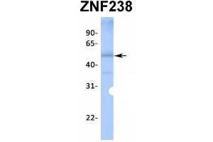 Western Blotting (WB) image for anti-Zinc Finger Protein 238 (ZNF238) (N-Term) antibody (ABIN2776459)