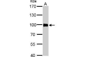 WB Image Villin antibody detects VIL1 protein by Western blot analysis. (Villin 1 抗体  (N-Term))