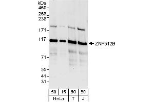 anti-Zinc Finger Protein 512B (ZNF512B) (AA 842-892) antibody