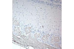 IHC on rat olfactory using Rabbit antibody to rat & mouse OMP (Olfactory Marker Protein): IgG  at a concentration of 20 µg/ml in paraffin embeded section. (OMP 抗体)