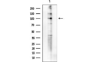 Western blot analysis of lysates from COLO205 cells(heat-shock treatment), using Phospho-FOXO3A (Ser413) Antibody at 1/1000 dilution.