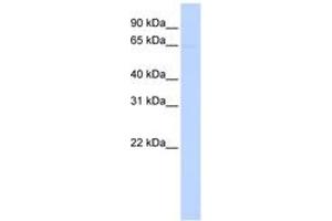 Image no. 1 for anti-Phosphatidylinositol Glycan Anchor Biosynthesis, Class Z (PIGZ) (AA 36-85) antibody (ABIN6743037) (PIGZ 抗体  (AA 36-85))