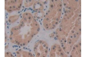 Immunohistochemistry (IHC) image for anti-Protein Kinase (CAMP-Dependent, Catalytic) Inhibitor beta (PKIB) (AA 8-76) antibody (ABIN7443077)