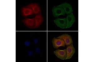 ABIN6262067 and ABIN6279097 staining Hela cells by IF/ICC.
