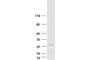 Western Blotting (WB) image for Second Mitochondria-Derived Activator of Caspase (DIABLO) (Transcript Variant 3) protein (Myc-DYKDDDDK Tag) (ABIN2719468)