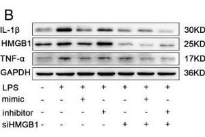 The effects of miR-339-5p and HMGB1-siRNA on LPS-induced RAW264. (GAPDH 抗体)