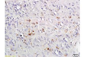 Formalin-fixed and paraffin embedded rat exfoliated cells tissue labeled with Anti-CCR4 Polyclonal Antibody, Unconjugated (ABIN738666) at 1:200 followed by conjugation to the secondary antibody and DAB staining (CCR4 抗体  (AA 201-300))