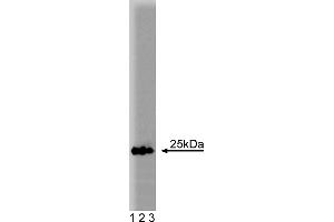 Western Blotting (WB) image for anti-RAB5A, Member RAS Oncogene Family (RAB5A) (AA 1-215) antibody (ABIN968139) (RAB5 抗体  (AA 1-215))